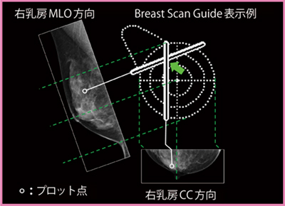 図4　Breast Scan Guide