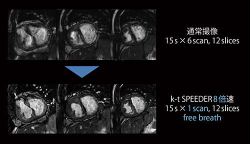 図1　不整脈症例における自由呼吸下のk-t SPEEDER使用例 （画像ご提供：一般財団法人厚生会 仙台厚生病院様）