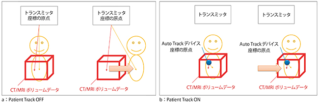 図3　Patient Trackの概要図