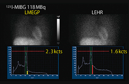 図3　LMEGPコリメータとLEHRコリメータの比較 （画像ご提供：国立循環器病研究センター様）