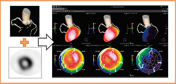 図8　NM Cardiac Fusion使用画像 （データご提供：鹿児島大学様）