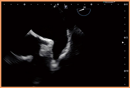 図5　PET-609MAの成人心臓断層像 （画像ご提供：桜橋渡辺病院心臓血管センター・大西俊成先生）