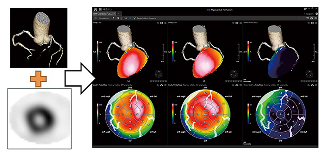 図6　NM Cardiac Fusion使用画像 （データご提供：鹿児島大学様）