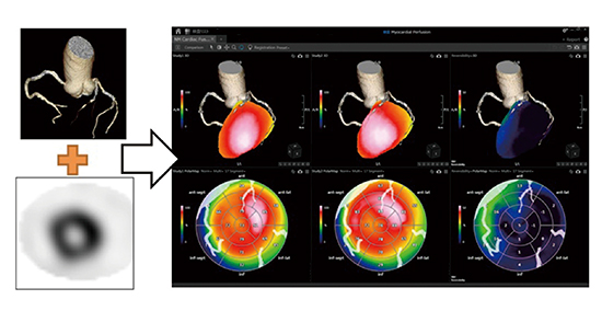 図5　NM Cardiac Fusion使用画像 （画像ご提供：鹿児島大学様）