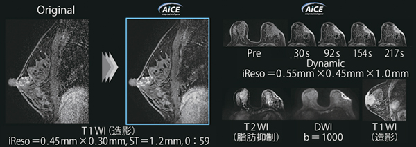 図1　さまざまなコントラストに適用したAiCE画像 （左画像ご提供：亀田クリニック様，右画像ご提供：市立奈良病院様）