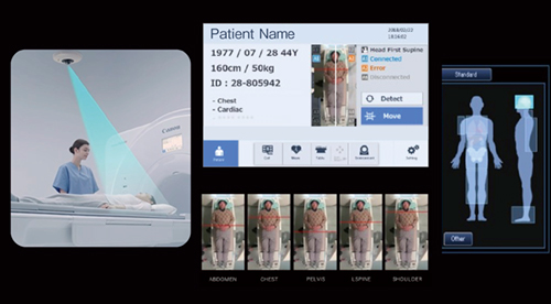 図6　ポジショニング時のワークフロー改善機能 シーリングカメラにより患者の特徴点を認識し，検出した撮像部位をインテリジェントモニタに表示する。
