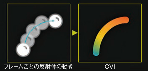 図6　CVIのバブルトラッキングとイメージング