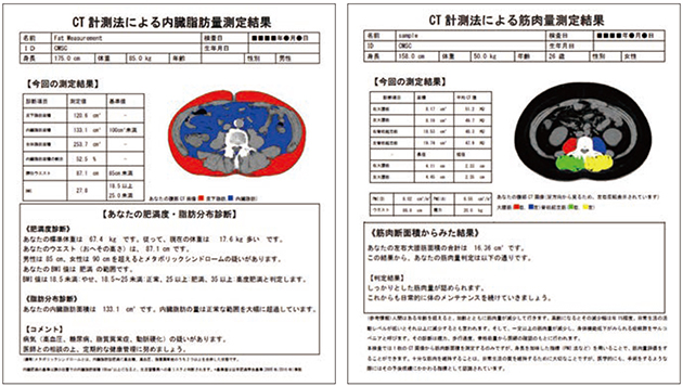 図2　簡易レポート機能 左：内臓脂肪量評価，右：筋肉量評価