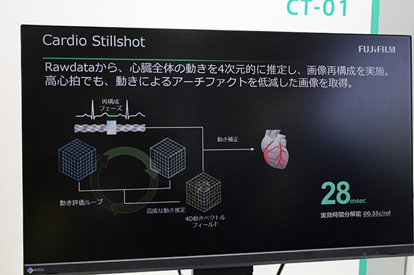 Cardio StillShotは心臓の動きを四次元的に推定して補正することで時間分解能の高い画像を提供