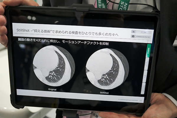 モーションアーチファクトを低減する「Body StillShot」を搭載