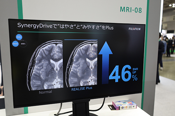 SynergyDriveのREALISE Plusで従来に比べてSNRを46％向上