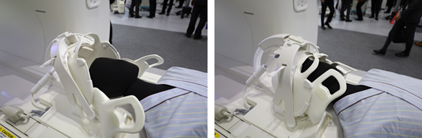 片手でセッティングが可能な頭頸部用コイル「FlexFit Neuro Coil」。左の状態からレバーをスライドさせるだけでセッティング完了（右）