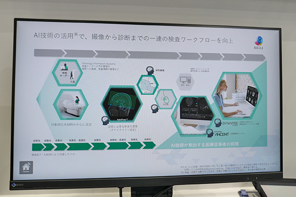 AI技術を活用して撮像から診断までのワークフローをサポートして効率的な検査を支援