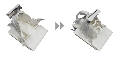 図3　FlexFit Neuroコイル アタッチメント交換不要の一体型頭頸部コイルで，被検者の頭部形状にフィットしたセッティングが，無段階調整でスライドすることにより可能である。