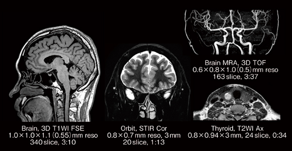 図4　FlexFit Neuroコイルで撮像したボランティア画像