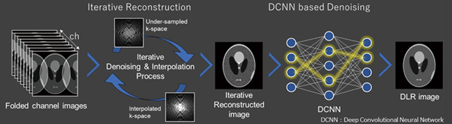 図5　IP-RAPIDとSynergy DLRを組み合わせた画像処理技術 繰り返し演算処理を行う独自の高速撮像法IP-RAPIDと，AI技術を活用して新たに開発したノイズ除去技術Synergy DLRを組み合わせることで，より短時間で高画質な画像の取得が期待できる。