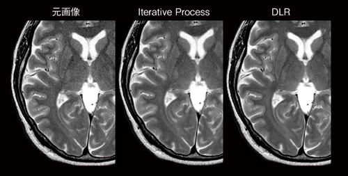 図6　元画像，Iterative Process，DLRの画像比較