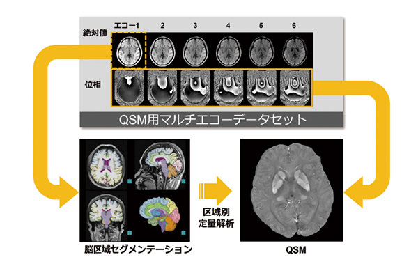図10　SYNAPSE VINCENT Coreで解析されたマルチエコーデータによる脳区域別の定量解析