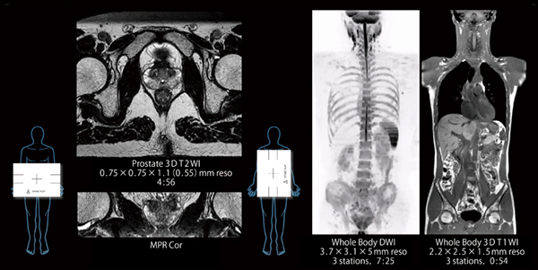 図2　腹部用受信コイルの横置き，縦置きの使用例