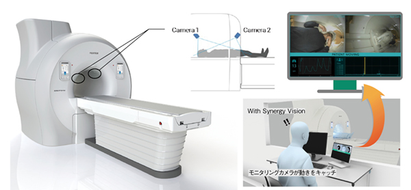 図1　ECHELON Synergyと被検者見守りシステムSynergy Visionの概要 ガントリ内の頭尾方向に2つのカメラを搭載しており，被検者を近距離から監視することができる。また，被検者がガントリからはい出してくるような大きな動きをした場合は，モニタに通知の表示と通知音により，操作者に知らせてくれる。