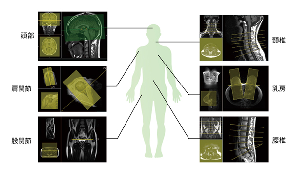 図8　スライスライン設定サポート機能の適用部位を拡大 3D画像解析システムSYNAPSE VINCENT＊7で培ってきた臓器認識技術を適用し，AI技術を活用したスライスライン設定サポート機能を搭載している。
