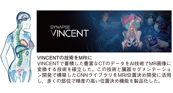 図6　全身幅広く進化したAutoPose 従来の頭部，脊椎，肩関節，乳房，股関節，膝関節に加え，新たに心臓，腹部，骨盤にも対応し，全身を広範囲でカバーしている。