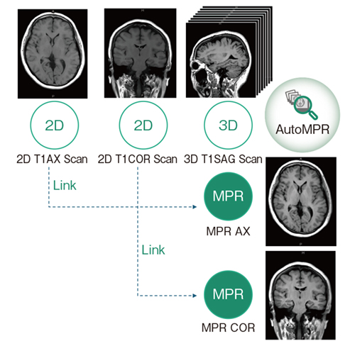 図8　AutoMPRの概要 3Dデータから，2D画像と同じスライス位置，オブリーク，厚さ，間隔，枚数，FOVの断面の2D断面画像を再構成する機能である。3Dデータが作られたときに，自動で再構成を開始して画像を作成する。