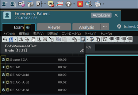 図11　体動検知時に画像確認を促す機能 体動判定の閾値を超えた動きを検出した場合，検査ウィンドウの検査タブとタスクに体動検知アイコンが表示される。