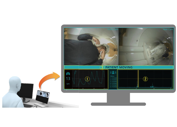 図1　Synergy Visionモニタ モニタには(1) 呼吸動波形と(2) 体動波形が表示され，MRI検査中に被検者がガントリからはい出してくるような大きな動き，咳やくしゃみのような小さな動きを検出し，(3) 体動発生を操作者に通知する。