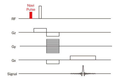 図3　動き検出のためのナビゲータエコーパルス パルスシーケンスにナビゲータエコーパルスを組み込み，時系列の変化をとらえることによって，体動を検出している。