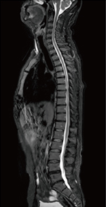 T2WI，DIXON Water，2station scan time：1:48/station スライス厚：4mm マトリックス：352×288