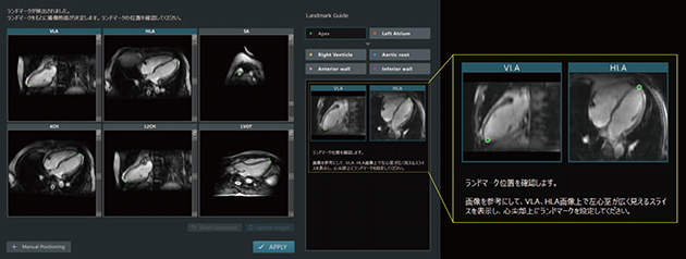 図4　Cardiac Slice Plan画面 撮像位置プランニング専用の3D画像を用いて解剖学的ランドマークを検出し，心臓検査に必要な断面の撮像位置設定を支援する。操作者は提示された撮像位置を確認し，必要に応じて修正することができる。