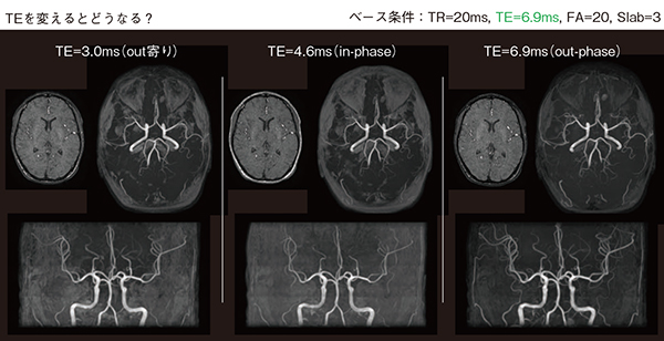 図2　第3回 「頭部MR Angiography」での基礎講演スライド（抜粋） MRI初学者でもわかりやすいよう，アプリケーション担当者が基礎からレクチャーしてくれるパート。