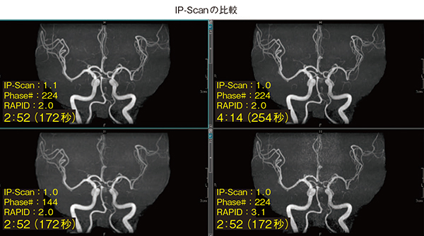 図3　第3回 「頭部MR Angiography」でのユーザー講演スライド（抜粋） 撮像プロトコールが定まった背景など，ユーザーが基礎検討を紹介しながらロジカルに解説してくれるパート。
