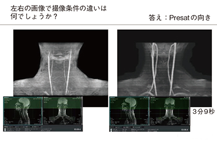 図4　第3回 「頭部MR Angiography」での「知って得する 頭頸部MRAのTips」（抜粋） FUJIFILM MRIならではの，画質改善アプローチをメーカーより情報提供いただくパート。