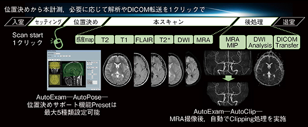 図4　Autoシリーズでの頭部MR撮像 頭部MRIを撮像の際，従来は約100回のマウス操作が必要であったが，位置決め，本スキャン，画像処理，DICOM転送までを装置に登録することにより，1クリックで検査が終了する。