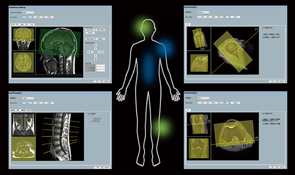 図5　AutoPoseの適用部位 従来より適用対象であった頭部撮像，椎体撮像に加え，膝関節撮像でも適用が可能となった。