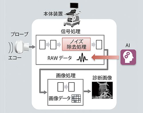 図1　超音波診断装置の処理フロー概念図