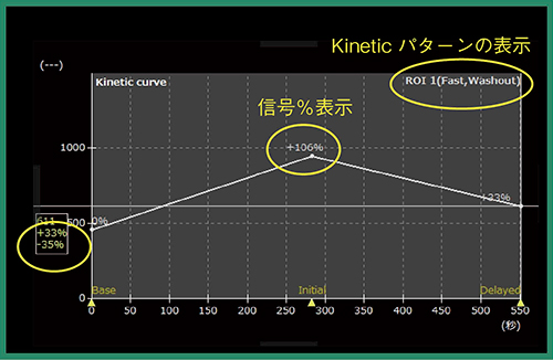 図6　SYNAPSE VINCENT乳腺解析ソフト