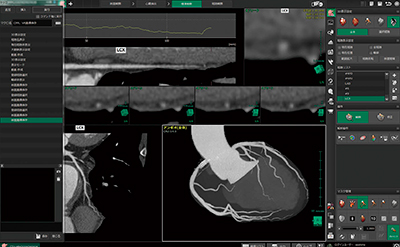 図2　マクロ実行中の画像例