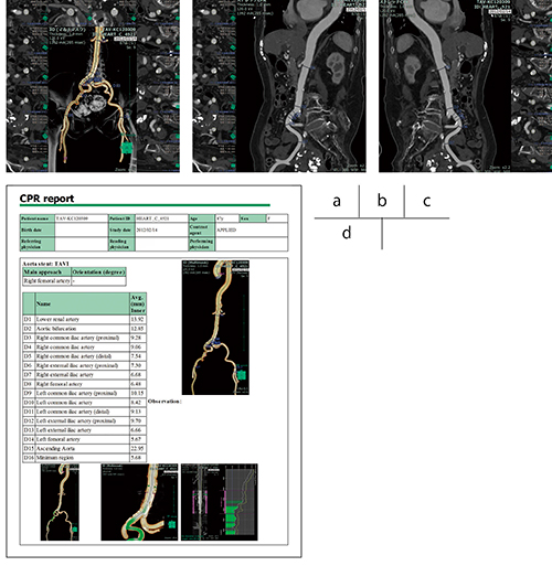 図4　血管CPR解析結果画像例