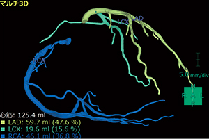 図7　各血管のサーフェス表示画像例