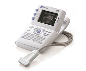 図1　世界初の携帯型超音波診断装置SonoSite 180（1999年）