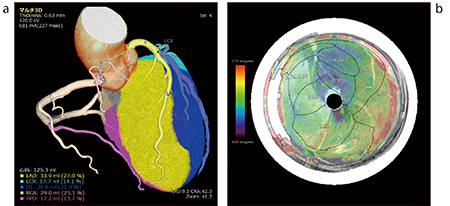 図2　心臓フュージョンの解析画像