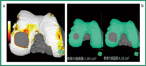 図2　膝関節解析の画面例
