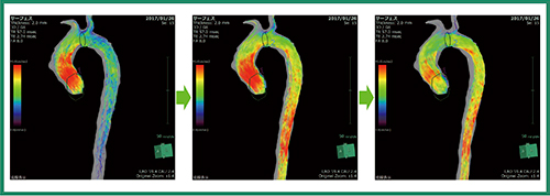 図3　4Dフローの画面例（左から右へ再生）