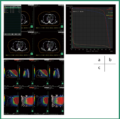 図4　RTアシストの画面例