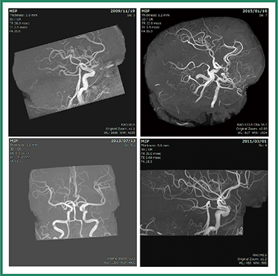 図5　MRA自動抽出結果例