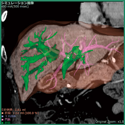 図2　自動抽出した胆管領域の結果画像例