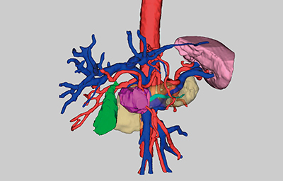 図1　膵臓を中心としたシミュレーション画像例 鏡視下シミュレータでは，動脈，静脈といった脈管系や脾臓，主膵管なども半自動，手動で抽出して合成表示することが可能である。